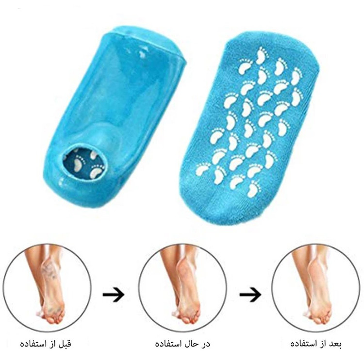 جوراب سیلیکونی ضد ترک پا